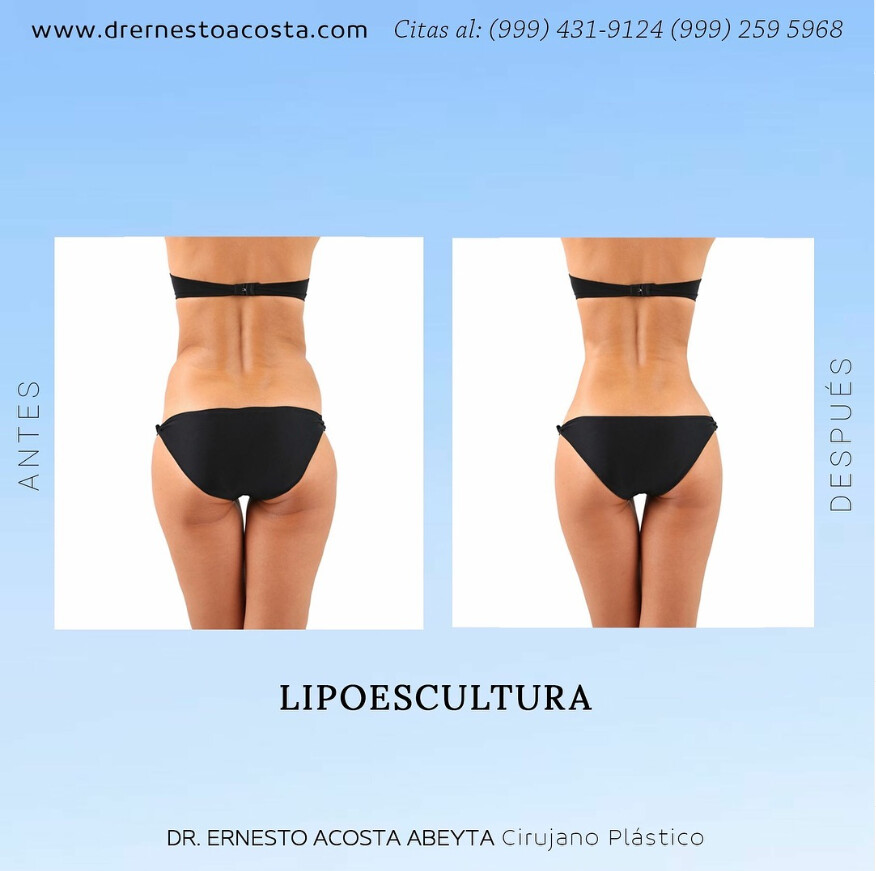 Before and After Result